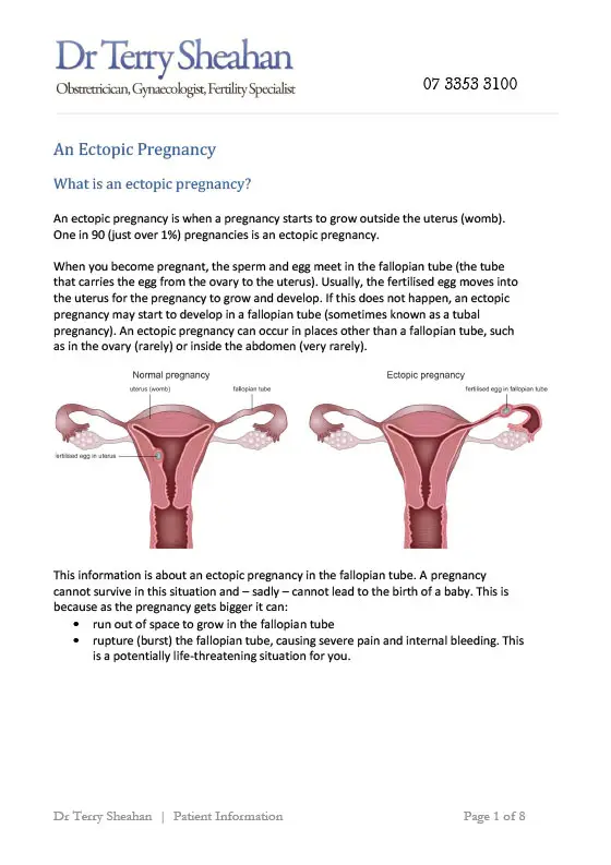 Endometriosis information